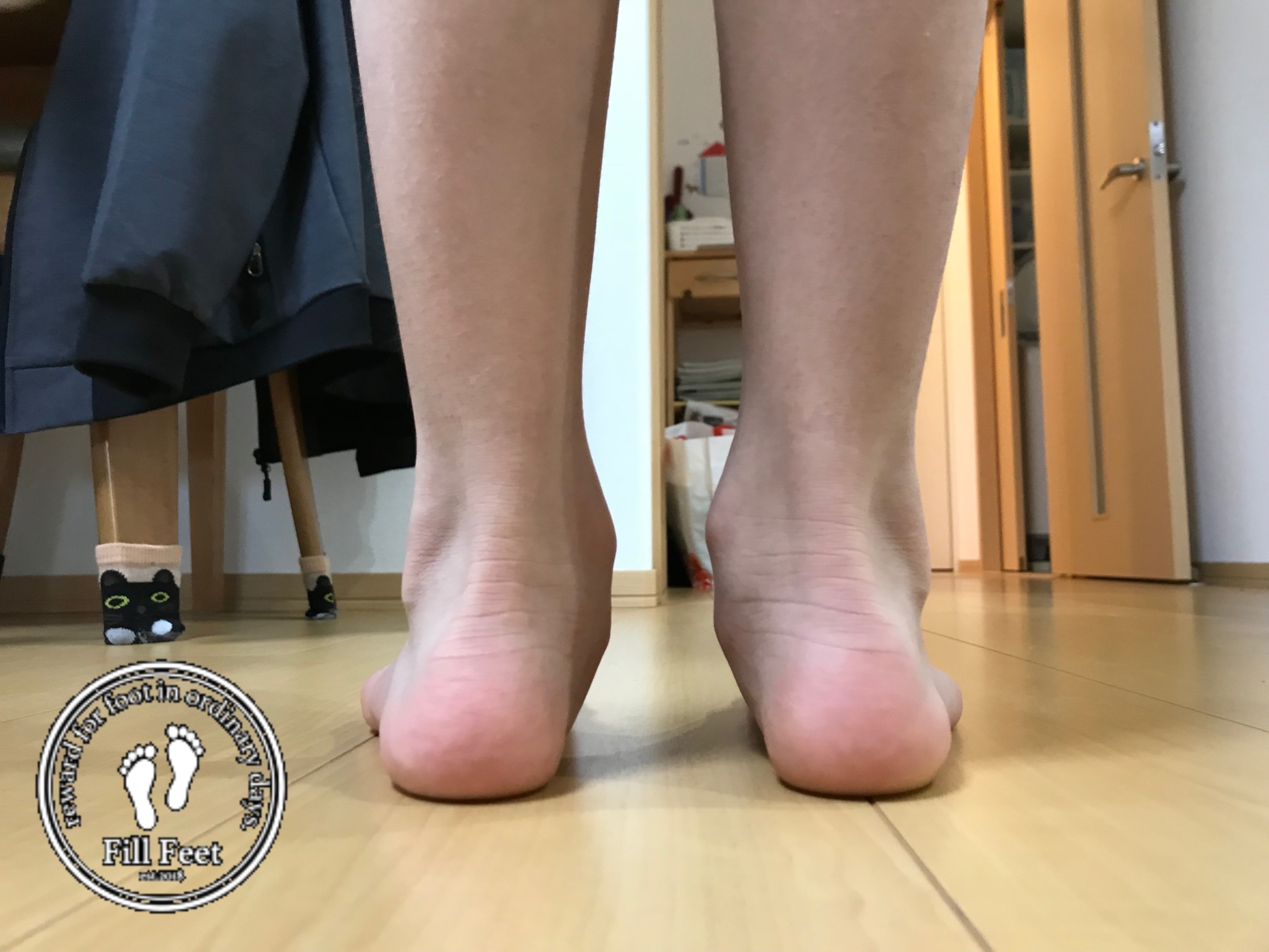 知られざる踵（かかと）の変形